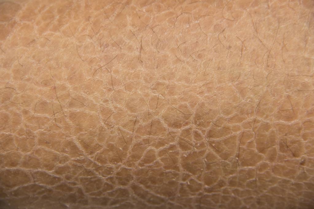 Pele Seca: O Que É, Causas e Como Cuidar Para Ter uma Pele Saudável